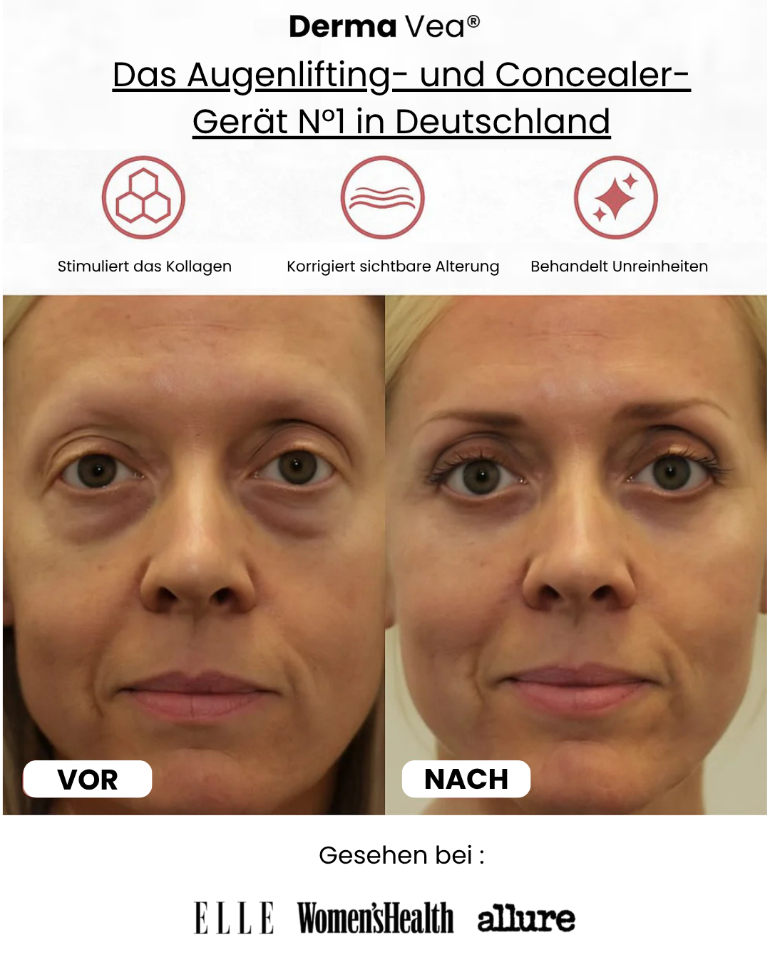 Derma Vea® - Augenlifting- und Concealer-Gerät