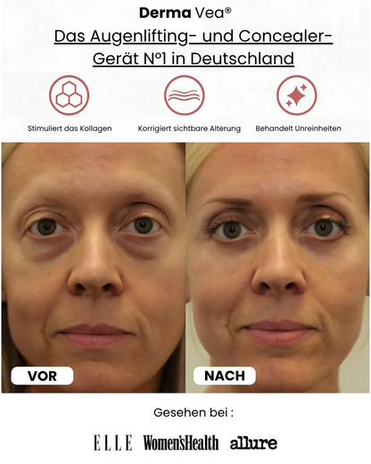 Derma Vea® - Augenlifting- und Concealer-Gerät
